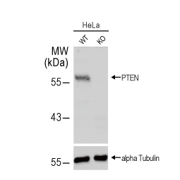PTEN antibody (GTX101025) PTEN antibody (GTX101025)